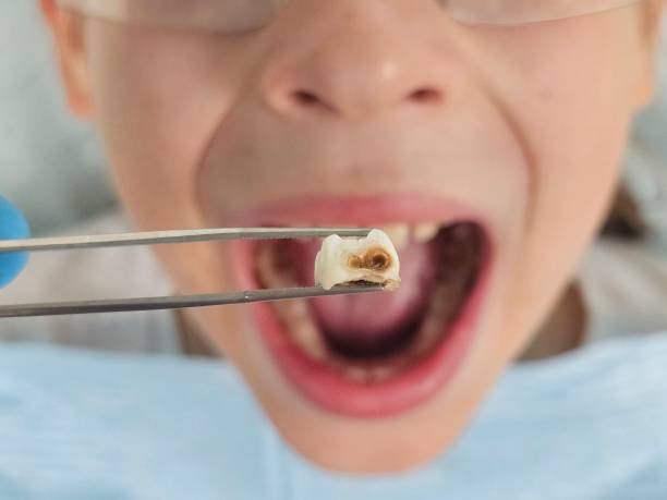 Best After-Hours Emergency Dentist in Knox, PA